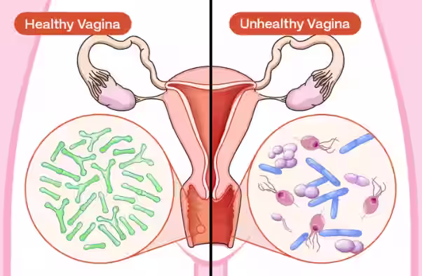 Illustration showing feminine microbiome balance